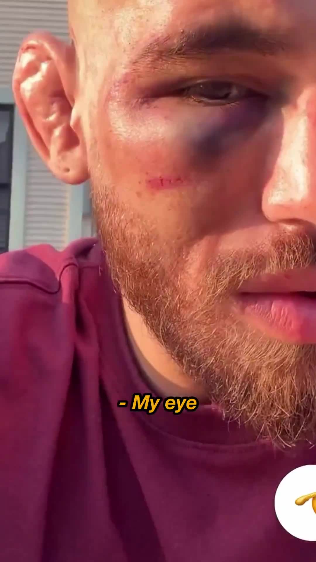 Jean Silva speaks for the first time following his loss to Diego Lopes