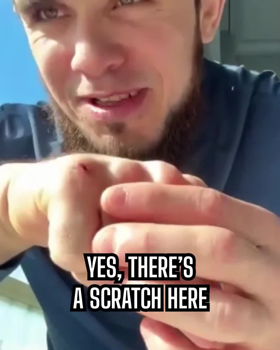 Chanko explains why he attacked Dillon Danis last night