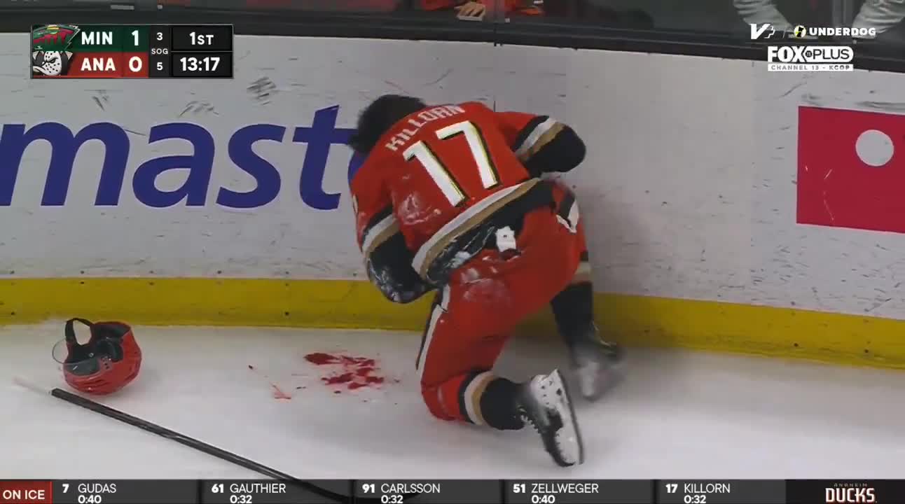 Alex Killorn is off to the room with a lot of blood on the ice. Friendly fire as Cutter Gauthier knocked the puck out of mid air right to Killorn's face.