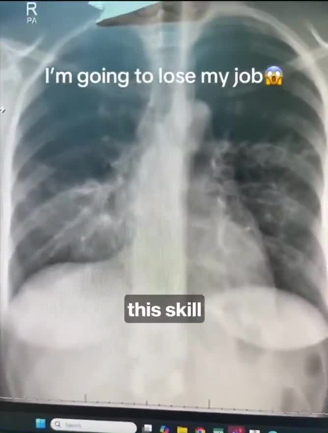 The moment when a doctor sees AI outperf...