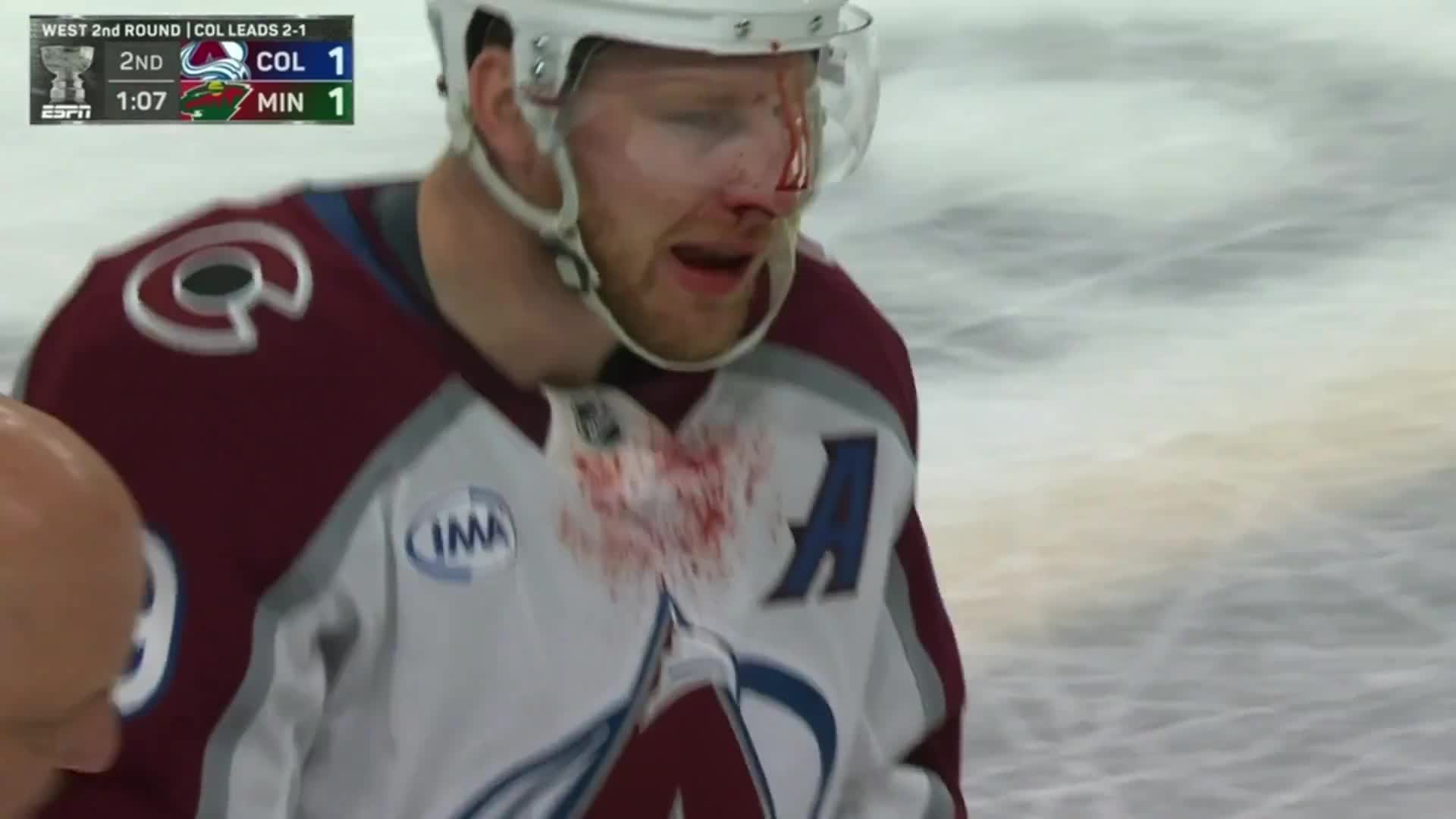 Nathan MacKinnon has left the game for repairs after a puck to the face left him bloodied